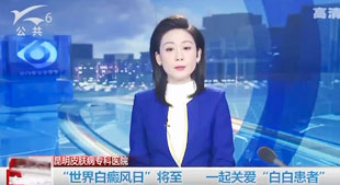 “世界白癜风日”将至一起关爱“白白患者”